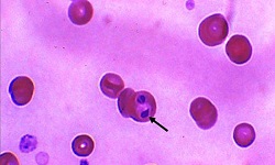 Babesia